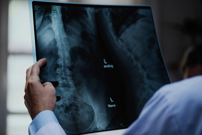 Doctor carefully examining an X-ray image